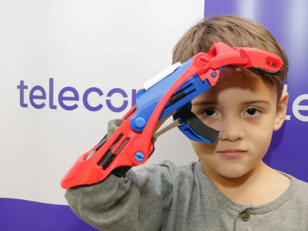 TELECOM ENTREGAN PRÓTESIS GRATUITAS EN TUCUMÁN