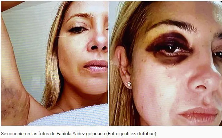 Captura