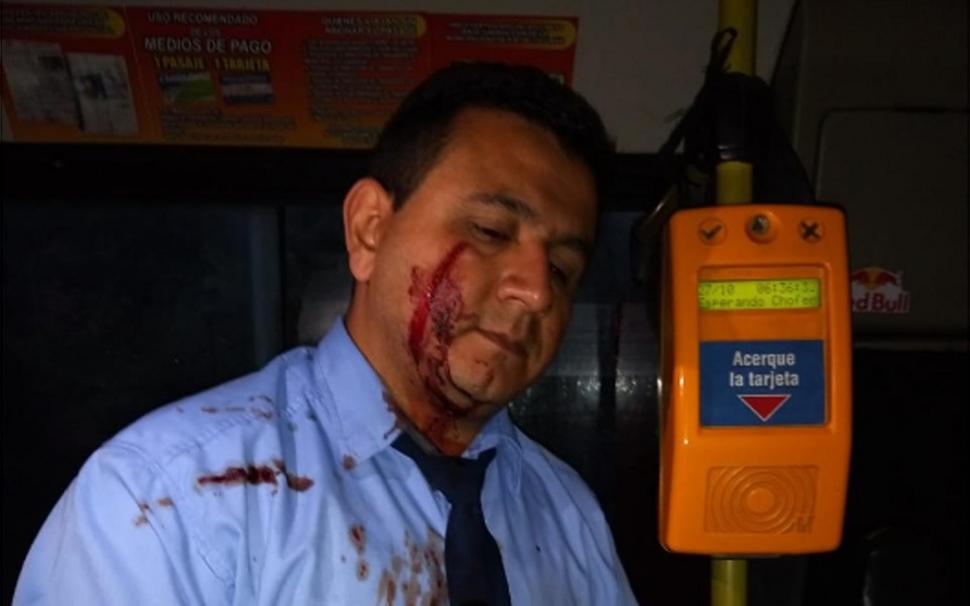 HERIDO. José Caram fue llevado a un sanatorio privado. Foto tomada de La Gaceta